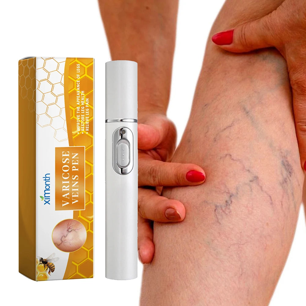LED Therapy Pen For Varicose Veins