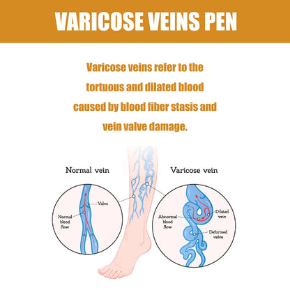 LED Therapy Pen For Varicose Veins