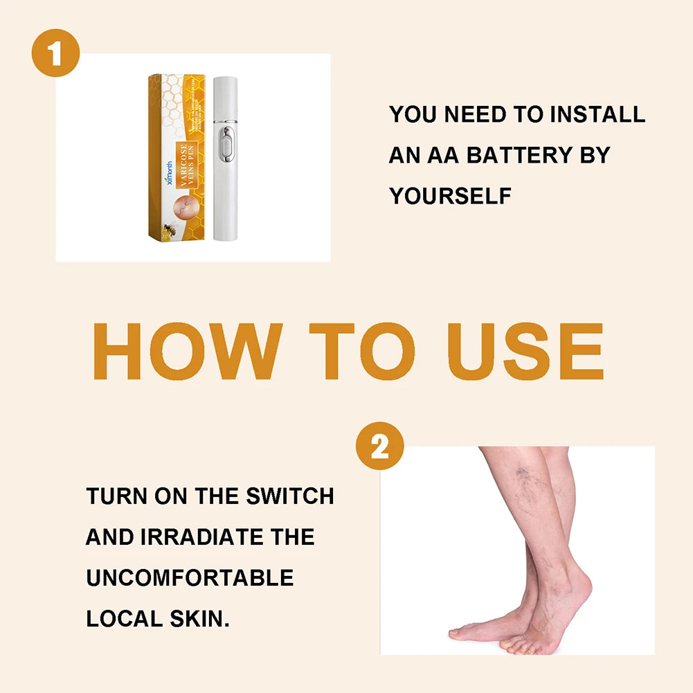 LED Therapy Pen For Varicose Veins